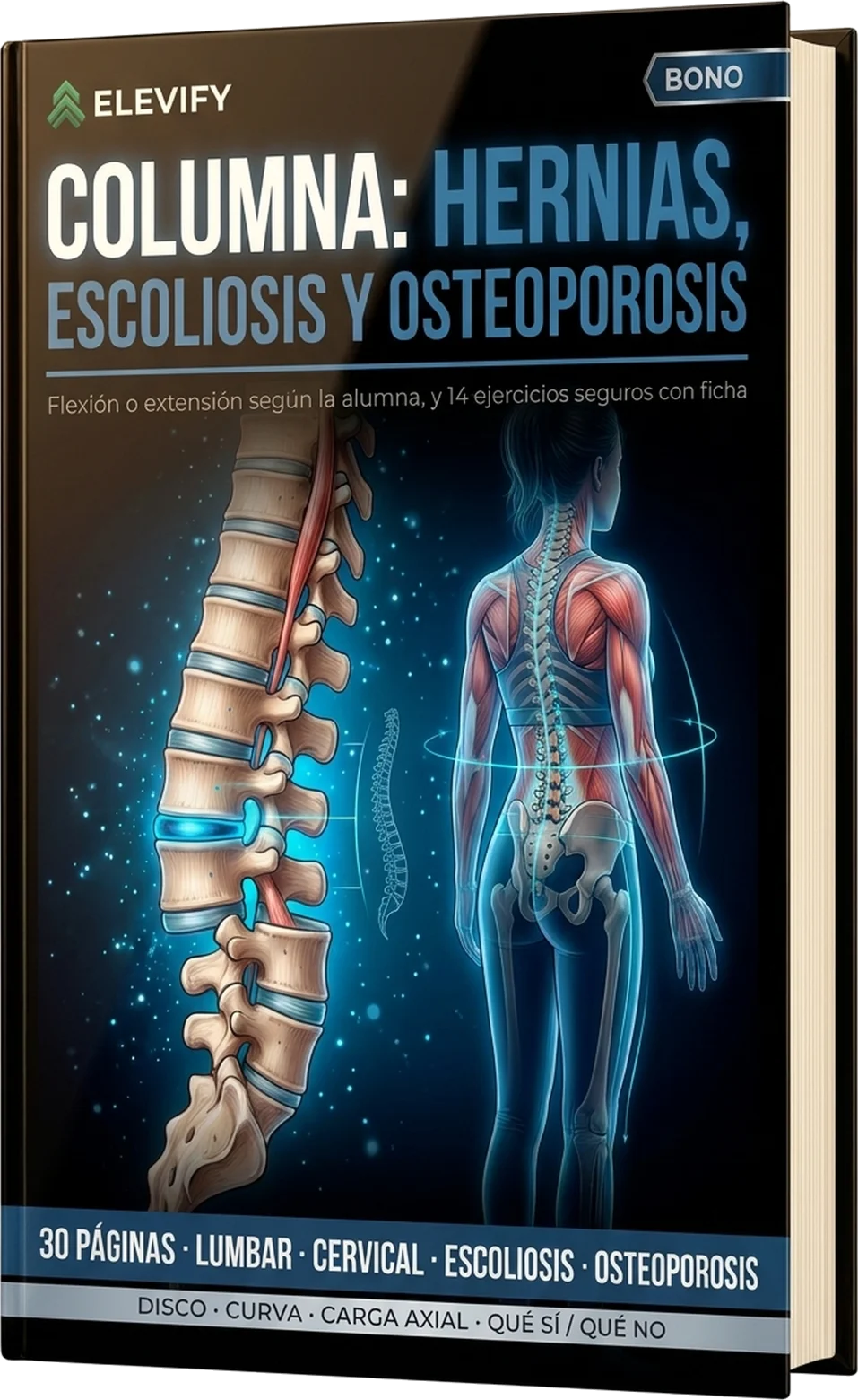 Columna: Hernias, Escoliosis y Osteoporosis